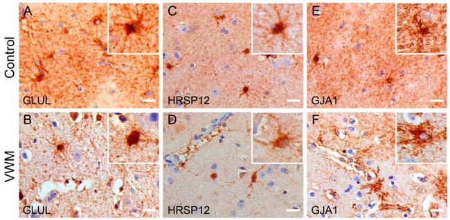 Glutamine Synthetase Antibody in Immunohistochemistry (IHC)