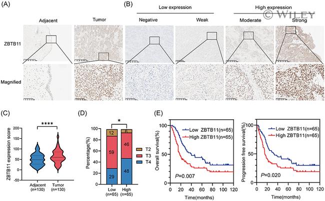 ZBTB11 Antibody in Immunohistochemistry (IHC)