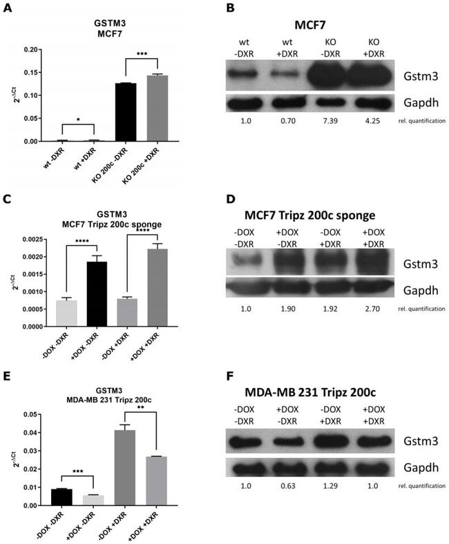 GSTM3 Antibody in Western Blot (WB)