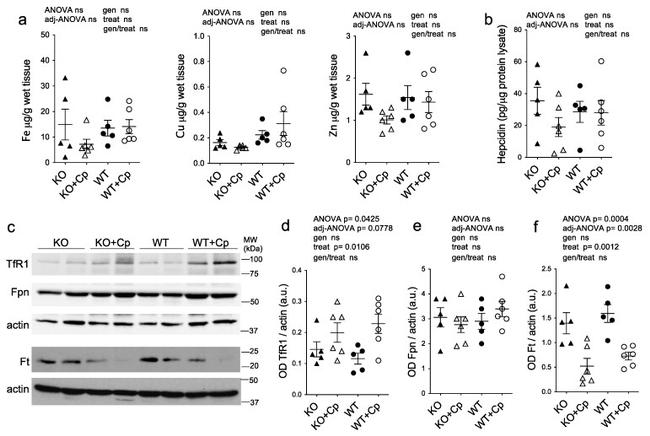 Ferroportin Antibody in Western Blot (WB)