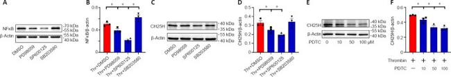 CH25H Antibody in Western Blot (WB)