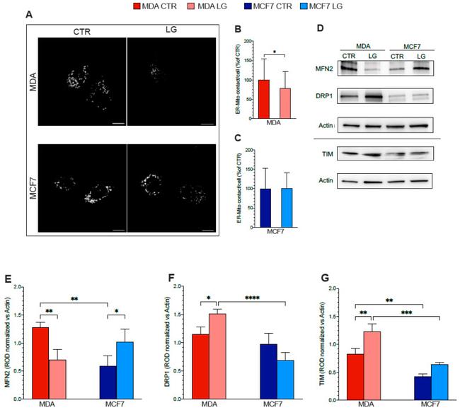 MFN2 Antibody in Western Blot (WB)