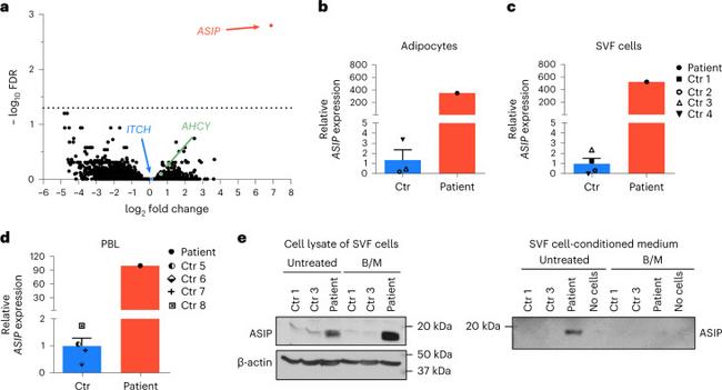 ASIP Antibody in Western Blot (WB)