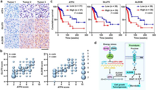 GLUT5 Antibody in Immunohistochemistry (IHC)