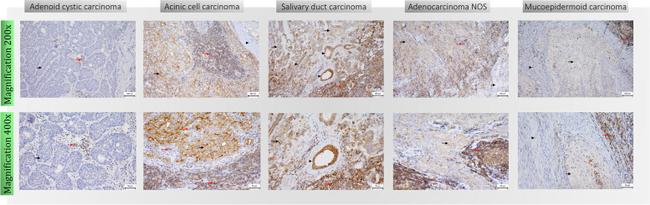 CD47 Antibody in Immunohistochemistry (IHC)