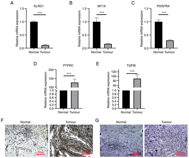 TGFBI Antibody in Immunohistochemistry (IHC)