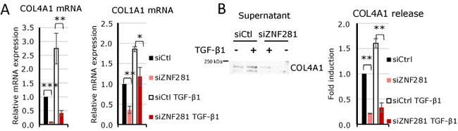 COL4A1 Antibody in Western Blot (WB)