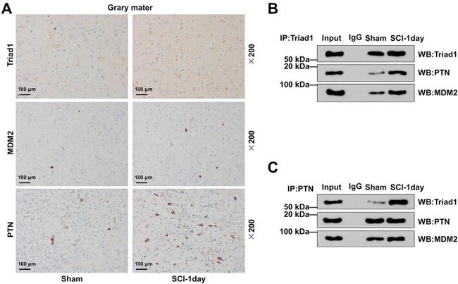 Pleiotrophin Antibody in Immunohistochemistry (IHC)