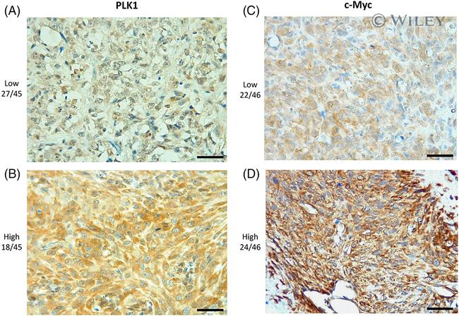 PLK1 Antibody in Immunohistochemistry (IHC)