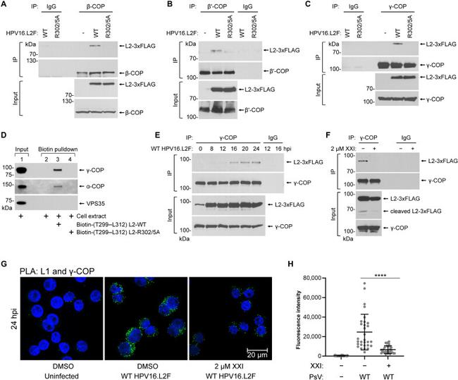 COPB2 Antibody in Western Blot, Immunoprecipitation (WB, IP)