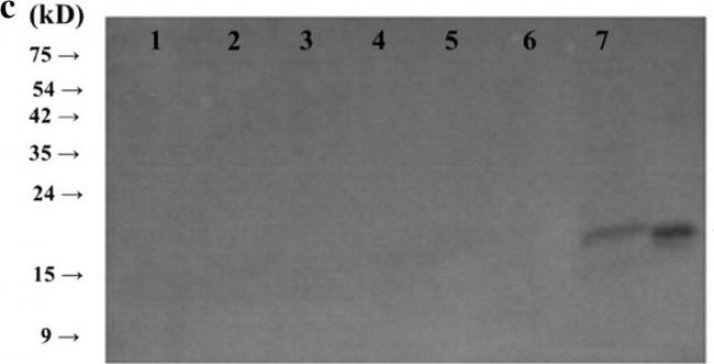 Rat IgG (H+L) Secondary Antibody in Western Blot (WB)