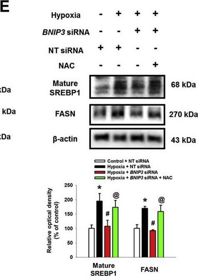 Rabbit IgG (H+L) Secondary Antibody in Western Blot (WB)