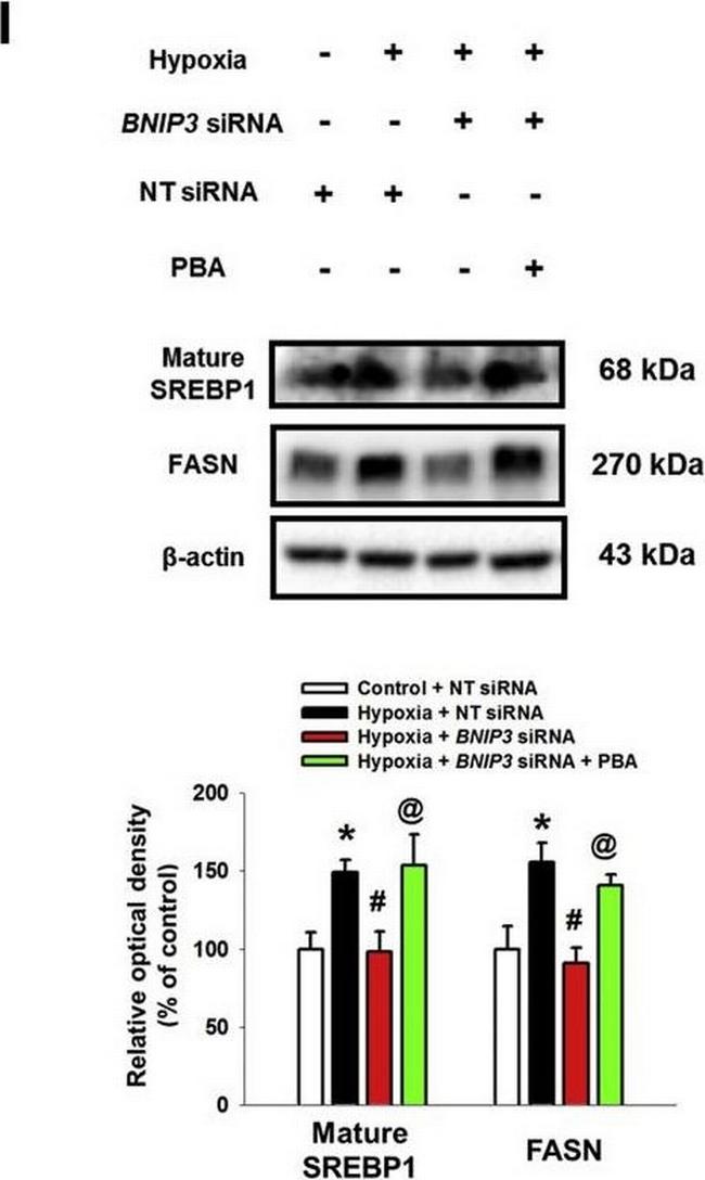 Rabbit IgG (H+L) Secondary Antibody in Western Blot (WB)