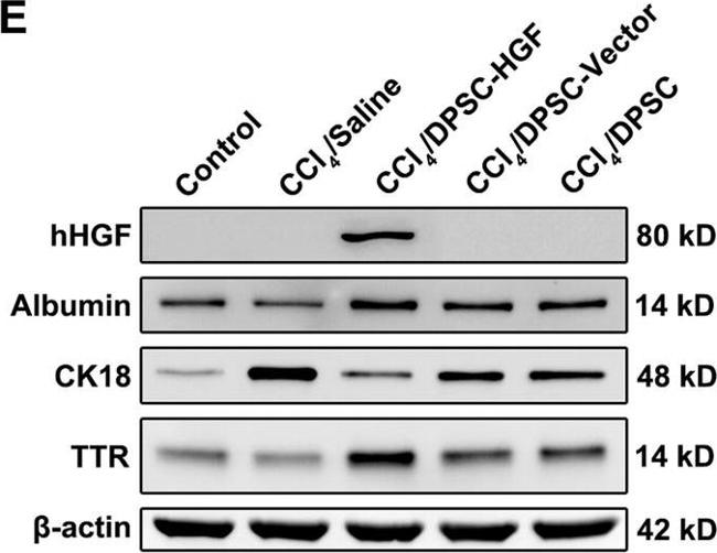 Rabbit IgG (H+L) Secondary Antibody in Western Blot (WB)