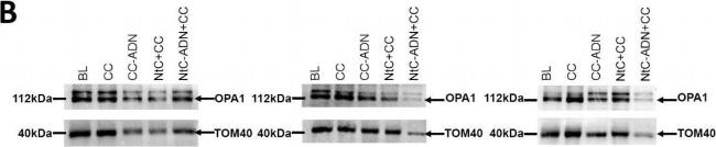 Rabbit IgG (H+L) Secondary Antibody in Western Blot (WB)