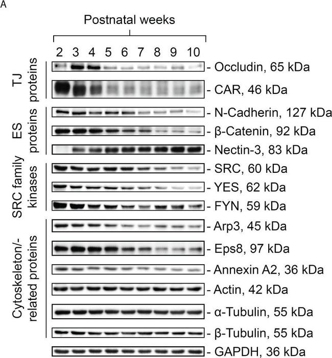 Rabbit IgG (H+L) Secondary Antibody in Western Blot (WB)