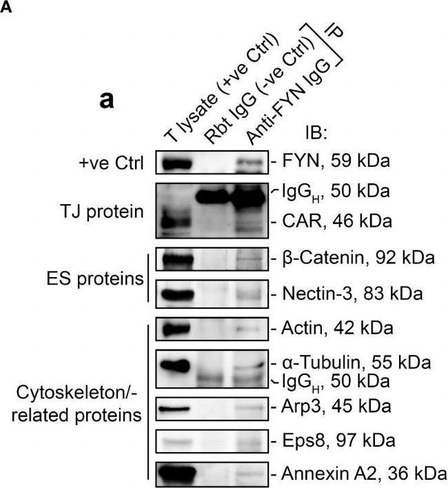 Rabbit IgG (H+L) Secondary Antibody in Western Blot (WB)