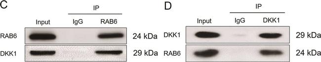 Rabbit IgG (H+L) Secondary Antibody in Western Blot (WB)