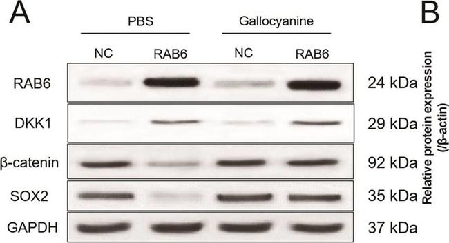 Rabbit IgG (H+L) Secondary Antibody in Western Blot (WB)