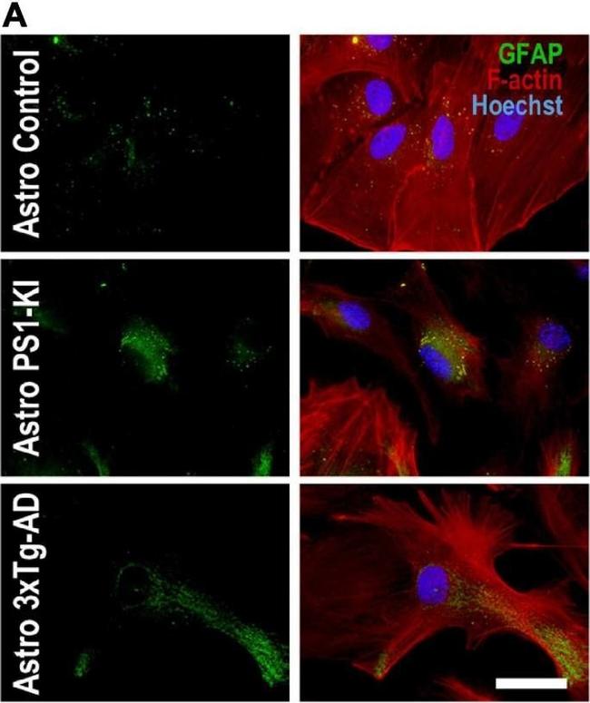 Rabbit IgG (H+L) Cross-Adsorbed Secondary Antibody in Immunocytochemistry (ICC/IF)