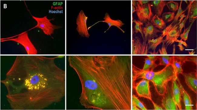 Rabbit IgG (H+L) Cross-Adsorbed Secondary Antibody in Immunocytochemistry (ICC/IF)