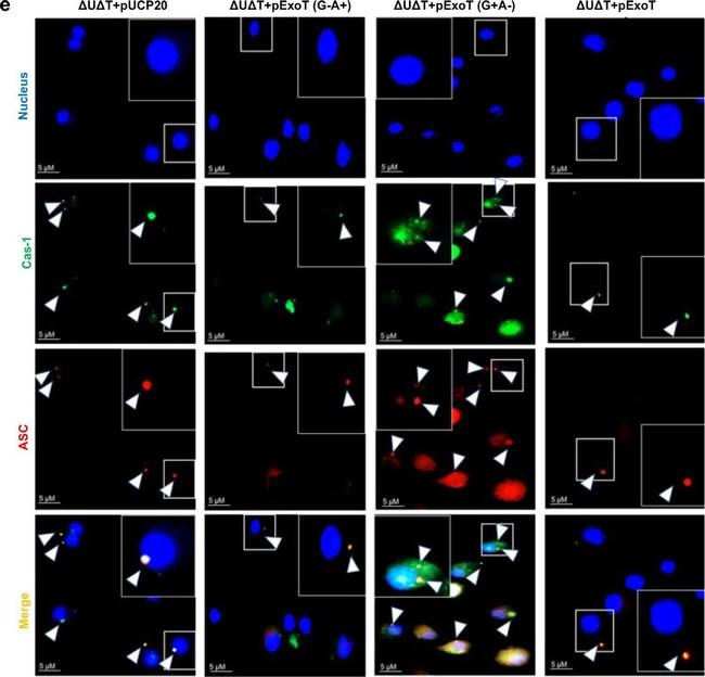 Mouse IgG (H+L) Cross-Adsorbed Secondary Antibody in Immunocytochemistry (ICC/IF)