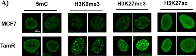 Mouse IgG (H+L) Cross-Adsorbed Secondary Antibody in Immunocytochemistry (ICC/IF)