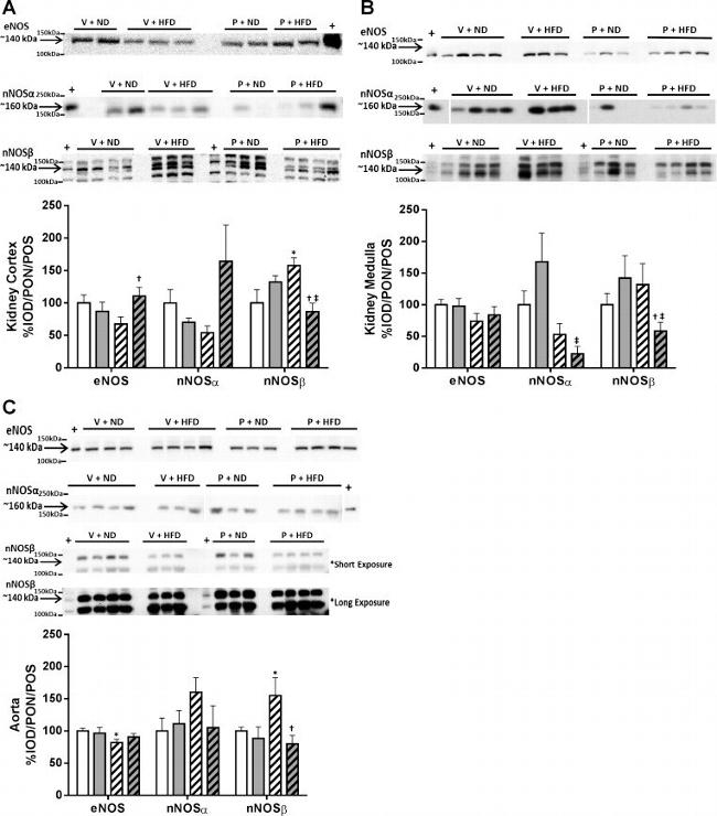 nNOS Antibody in Western Blot (WB)