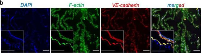 Mouse IgG (H+L) Cross-Adsorbed Secondary Antibody in Immunocytochemistry (ICC/IF)