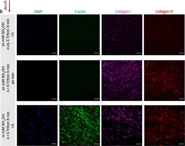 Mouse IgG (H+L) Cross-Adsorbed Secondary Antibody in Immunocytochemistry (ICC/IF)