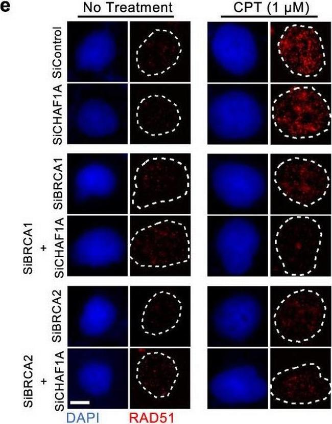 Rabbit IgG (H+L) Highly Cross-Adsorbed Secondary Antibody in Immunocytochemistry (ICC/IF)