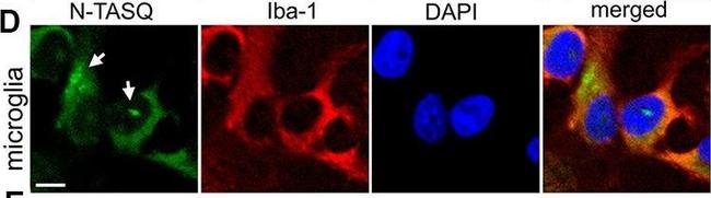 Mouse IgG (H+L) Cross-Adsorbed Secondary Antibody in Immunocytochemistry (ICC/IF)