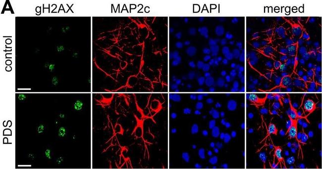 Rabbit IgG (H+L) Cross-Adsorbed Secondary Antibody in Immunocytochemistry (ICC/IF)