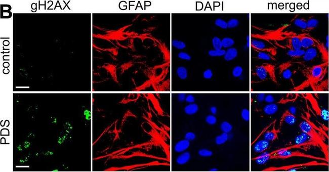 Rabbit IgG (H+L) Cross-Adsorbed Secondary Antibody in Immunocytochemistry (ICC/IF)