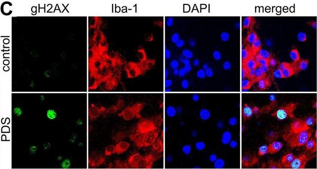 Rabbit IgG (H+L) Cross-Adsorbed Secondary Antibody in Immunocytochemistry (ICC/IF)