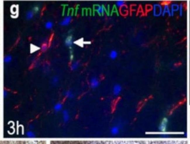 Mouse IgG (H+L) Cross-Adsorbed Secondary Antibody in Immunohistochemistry (IHC)