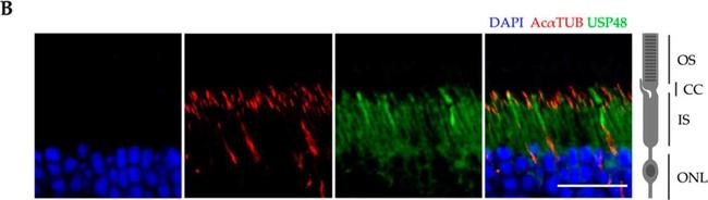 Mouse IgG (H+L) Cross-Adsorbed Secondary Antibody in Immunohistochemistry (IHC)