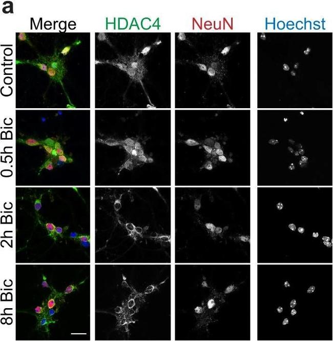 Mouse IgG (H+L) Cross-Adsorbed Secondary Antibody in Immunocytochemistry (ICC/IF)