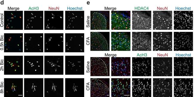 Mouse IgG (H+L) Cross-Adsorbed Secondary Antibody in Immunocytochemistry (ICC/IF)