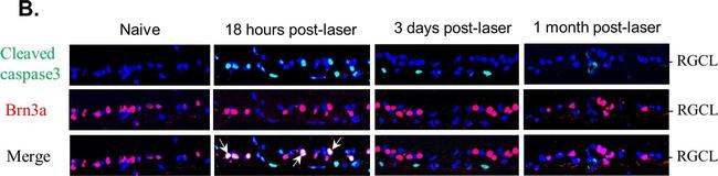 Mouse IgG (H+L) Cross-Adsorbed Secondary Antibody in Immunohistochemistry (Frozen) (IHC (F))