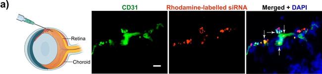 Rat IgG (H+L) Cross-Adsorbed Secondary Antibody in Immunohistochemistry (IHC)