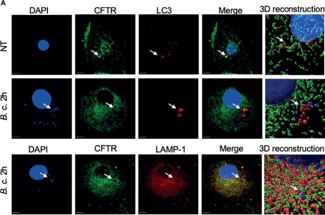 Rat IgG (H+L) Cross-Adsorbed Secondary Antibody in Immunocytochemistry (ICC/IF)