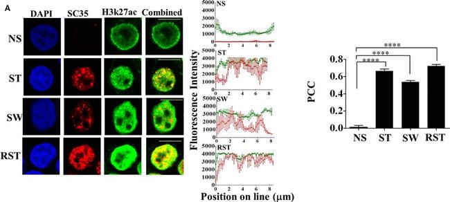 Mouse IgG (H+L) Highly Cross-Adsorbed Secondary Antibody in Immunocytochemistry (ICC/IF)