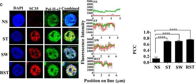 Mouse IgG (H+L) Highly Cross-Adsorbed Secondary Antibody in Immunocytochemistry (ICC/IF)