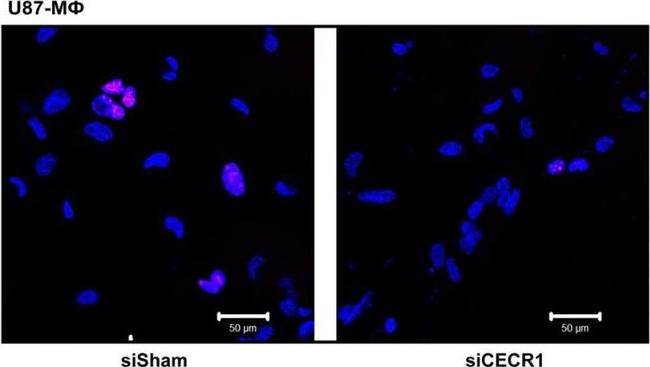 Mouse IgG (H+L) Cross-Adsorbed Secondary Antibody in Immunocytochemistry (ICC/IF)