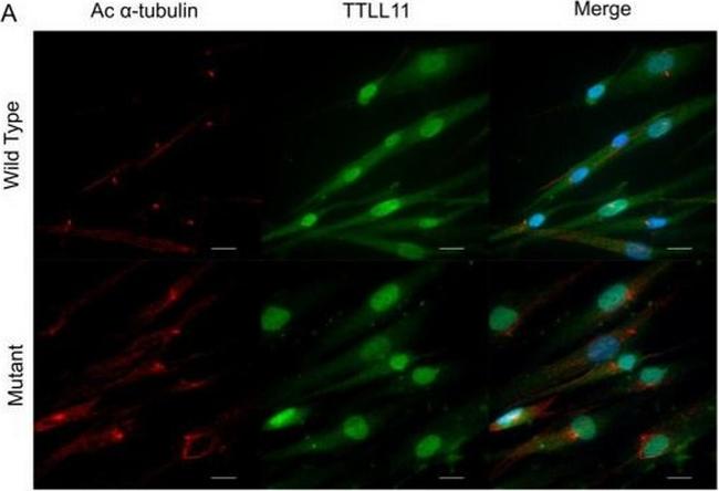 Rabbit IgG (H+L) Cross-Adsorbed Secondary Antibody in Immunocytochemistry (ICC/IF)