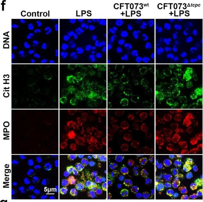 Rabbit IgG (H+L) Cross-Adsorbed Secondary Antibody in Immunocytochemistry (ICC/IF)