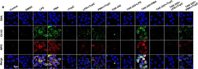 Rabbit IgG (H+L) Cross-Adsorbed Secondary Antibody in Immunocytochemistry (ICC/IF)