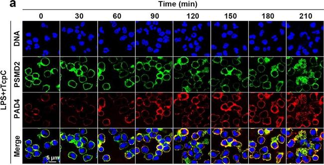 Rabbit IgG (H+L) Cross-Adsorbed Secondary Antibody in Immunocytochemistry (ICC/IF)