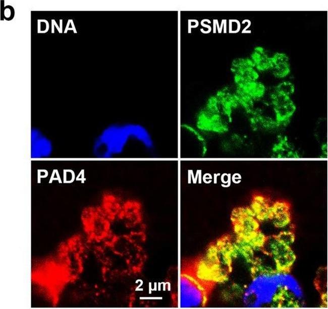 Rabbit IgG (H+L) Cross-Adsorbed Secondary Antibody in Immunocytochemistry (ICC/IF)